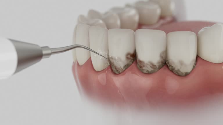 Trusted Dental Crowns And Bridges service in West Point, NY - Dentist Open Now